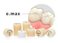 オールセラミック（e.max）