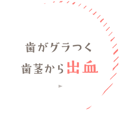 歯がグラつく 歯茎から出血